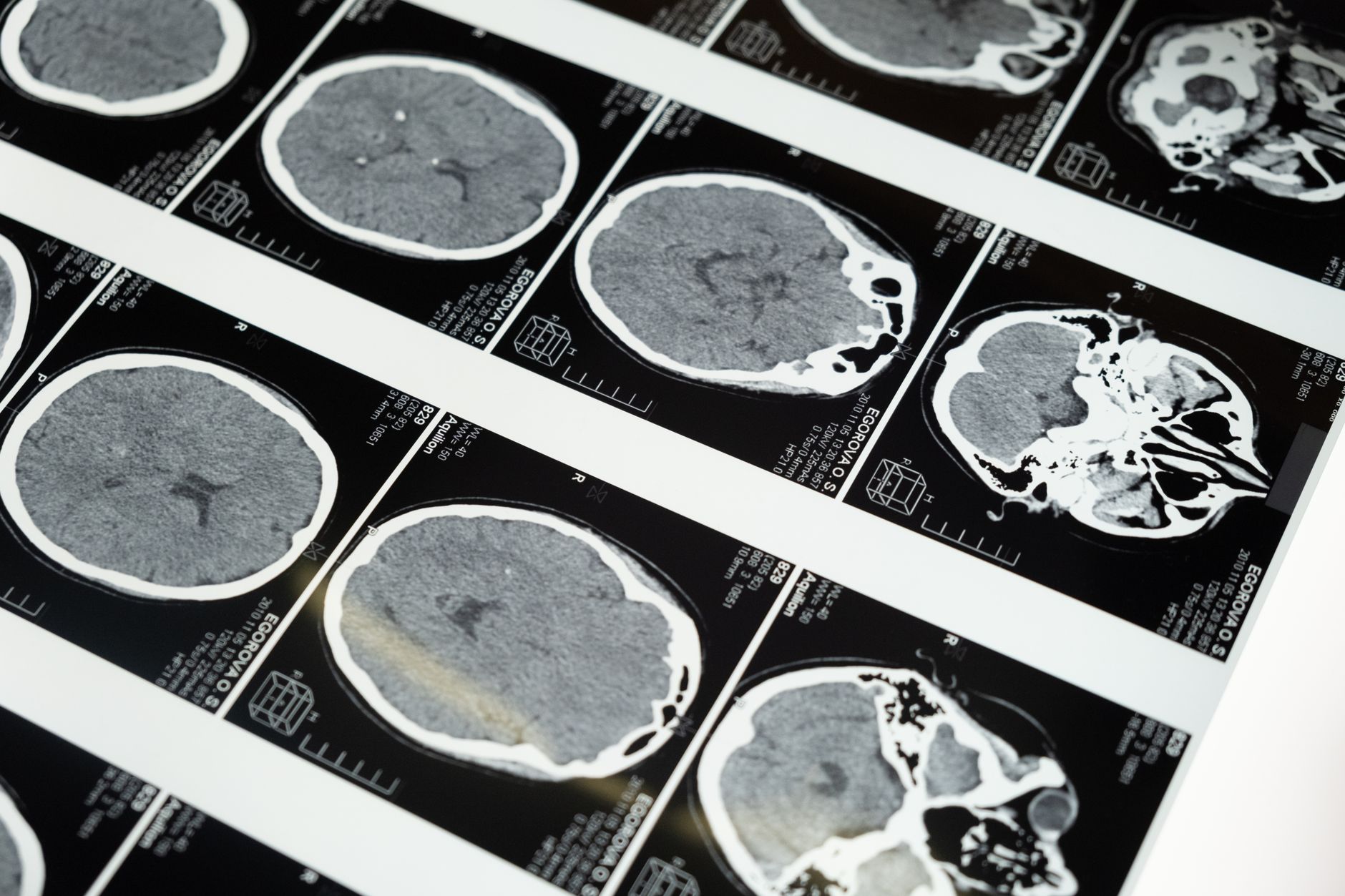 Medical researcher examining brain scan imagery related to brain-computer interface technology